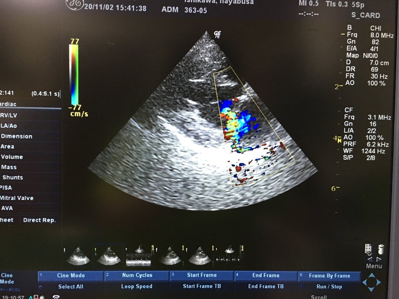 犬　心臓　超音波検査